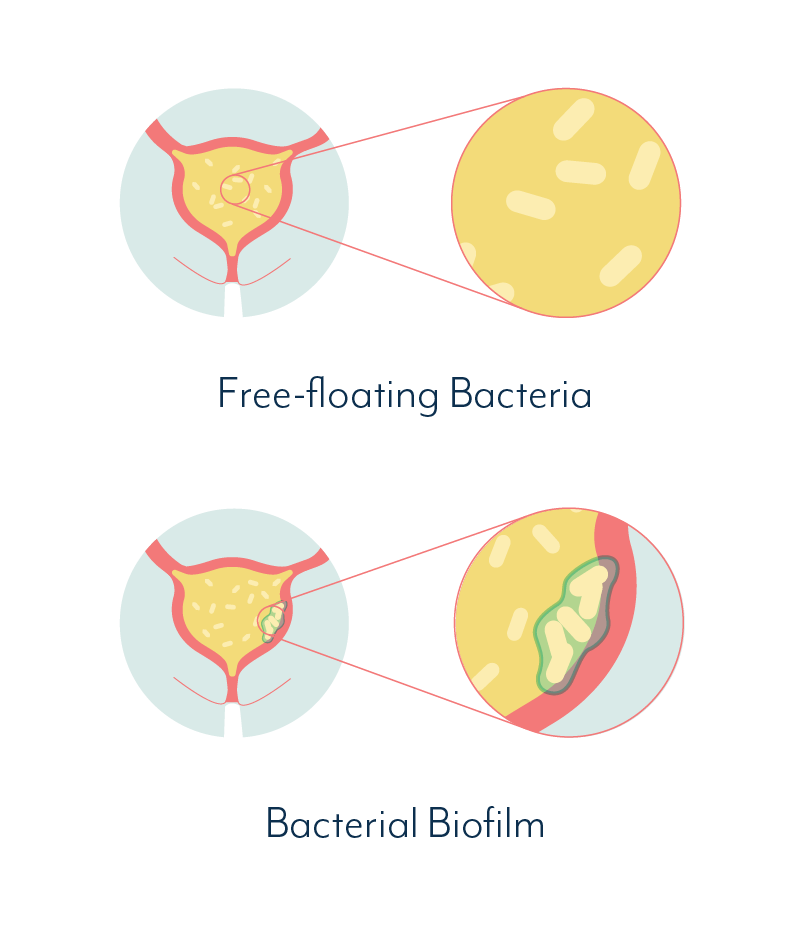 Simplified UTI Biofilm Explanation.png